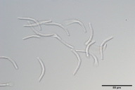 Sphaerulina quercicola