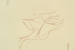 Dacrymyces chrysospermus