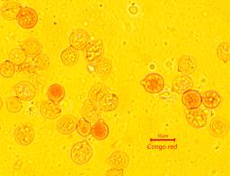 Naematelia encephala