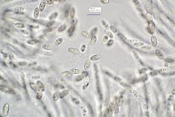 Cosmospora arxii