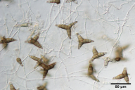 Asterosporium asterospermum