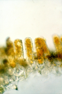 Taphrina populina