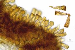 Puccinia striiformis