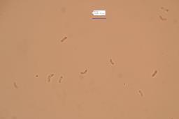 Skeletocutis albocremea