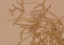 Trichia varia