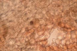 Arcyria cinerea
