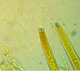 Ciboria coryli