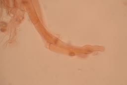 Calyptella capula