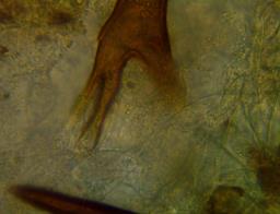 Scutellinia trechispora