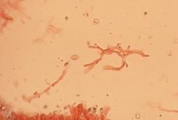 Mycena aetites