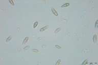 Venturia fraxini