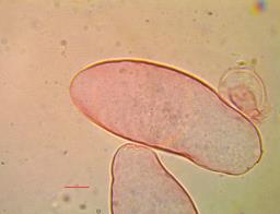 Tulosesus congregatus