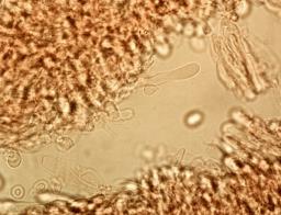 Mucronella bresadolae