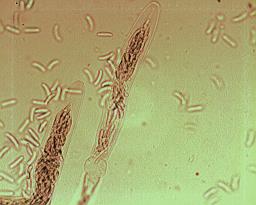 Diatrypella favacea