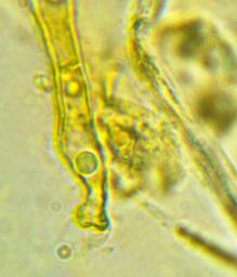 Ciboria coryli