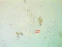 Fuscolachnum pteridis