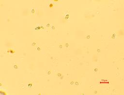 Cystodermella cinnabarina