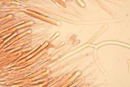 Calocera glossoides