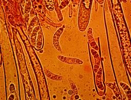 Rutstroemia alnobetulae