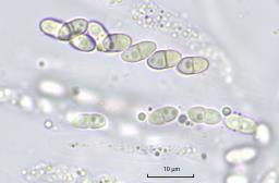 Dialonectria episphaeria