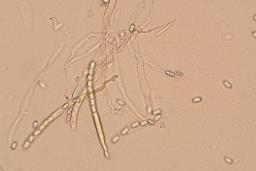 Otidea concinna