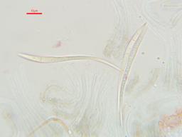 Therrya pini var. pini