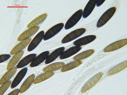Navicella pileata