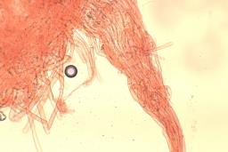Arrhenia