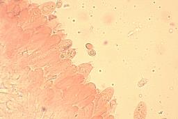 Melanoleuca luteolosperma