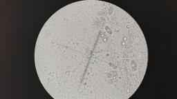 Pachyella aquatilis