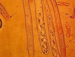 Rutstroemia alnobetulae