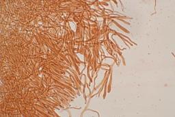 Dacrymyces capitatus