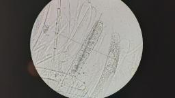 Pachyella aquatilis