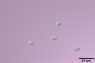 Erysiphe corylacearum