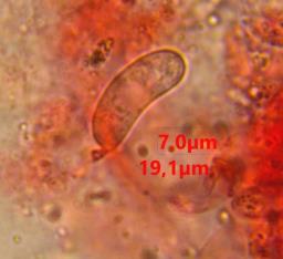Vuilleminia comedens
