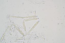 Tapesia lividofusca
