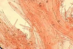 Galerina atkinsoniana