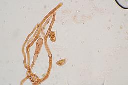 Dacrymyces capitatus