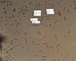 Diatrypella favacea