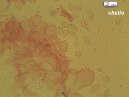 Linopodium filopes