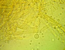 Trechispora mollusca