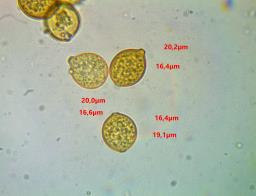 Botryobasidium simile