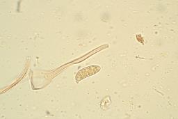 Dacrymyces chrysospermus