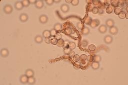 Arcyria cinerea