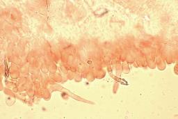 Melanoleuca luteolosperma