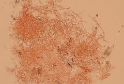 Gloeoporus taxicola