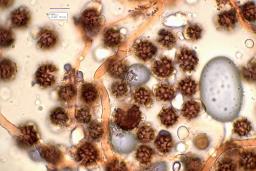 Scleroderma bovista