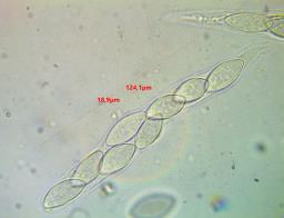 Wuestneia chrysostroma