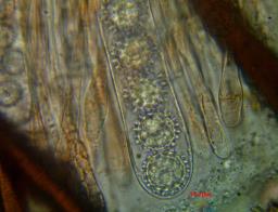 Scutellinia trechispora
