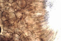 Tapesia lividofusca